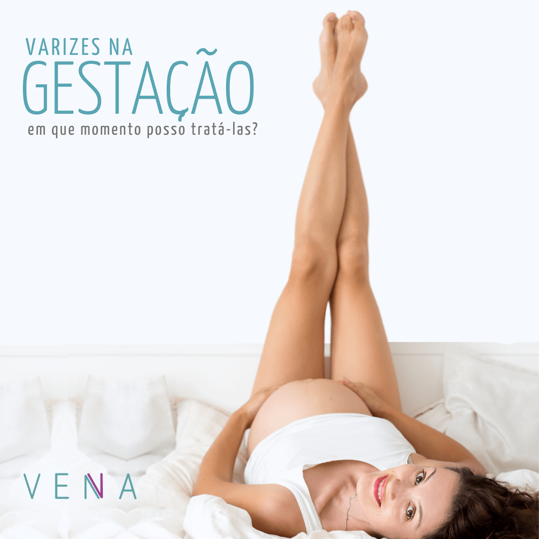 varizes-na-gestação