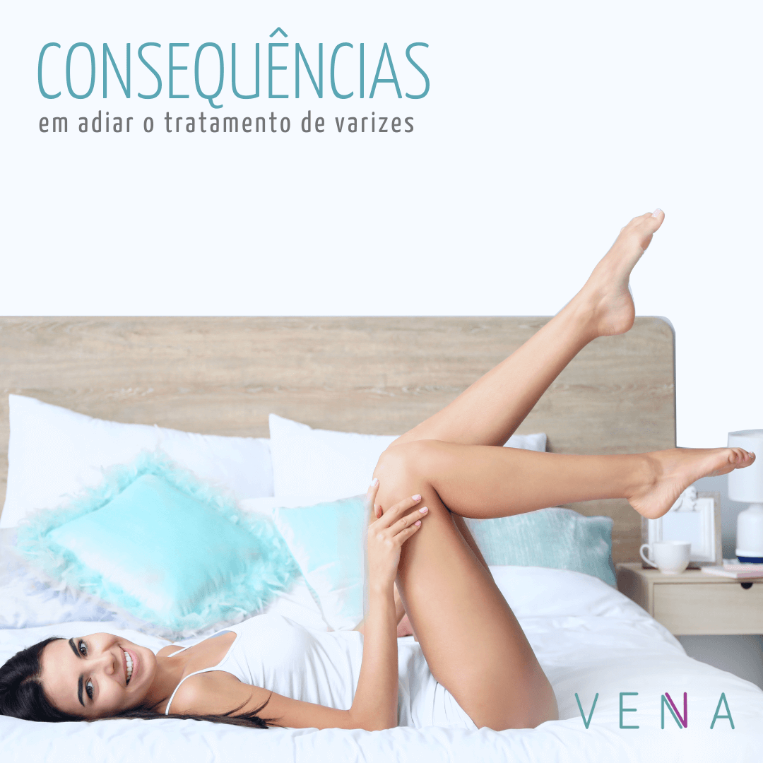 tratamento-varizes