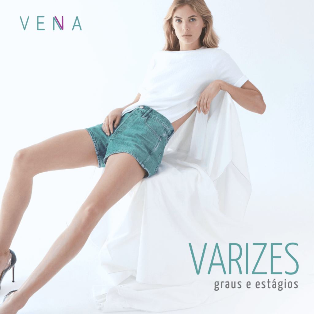 varizes-graus-e-estágios