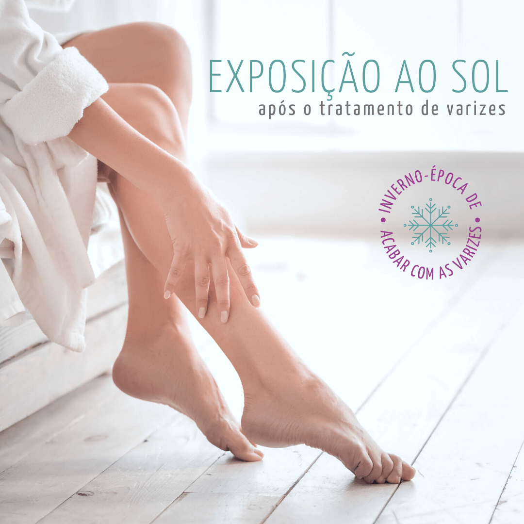exposição-ao-sol-tratamento-de-varizes