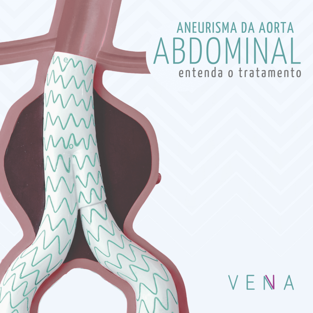 aneurisma-de-aorta-abdominal