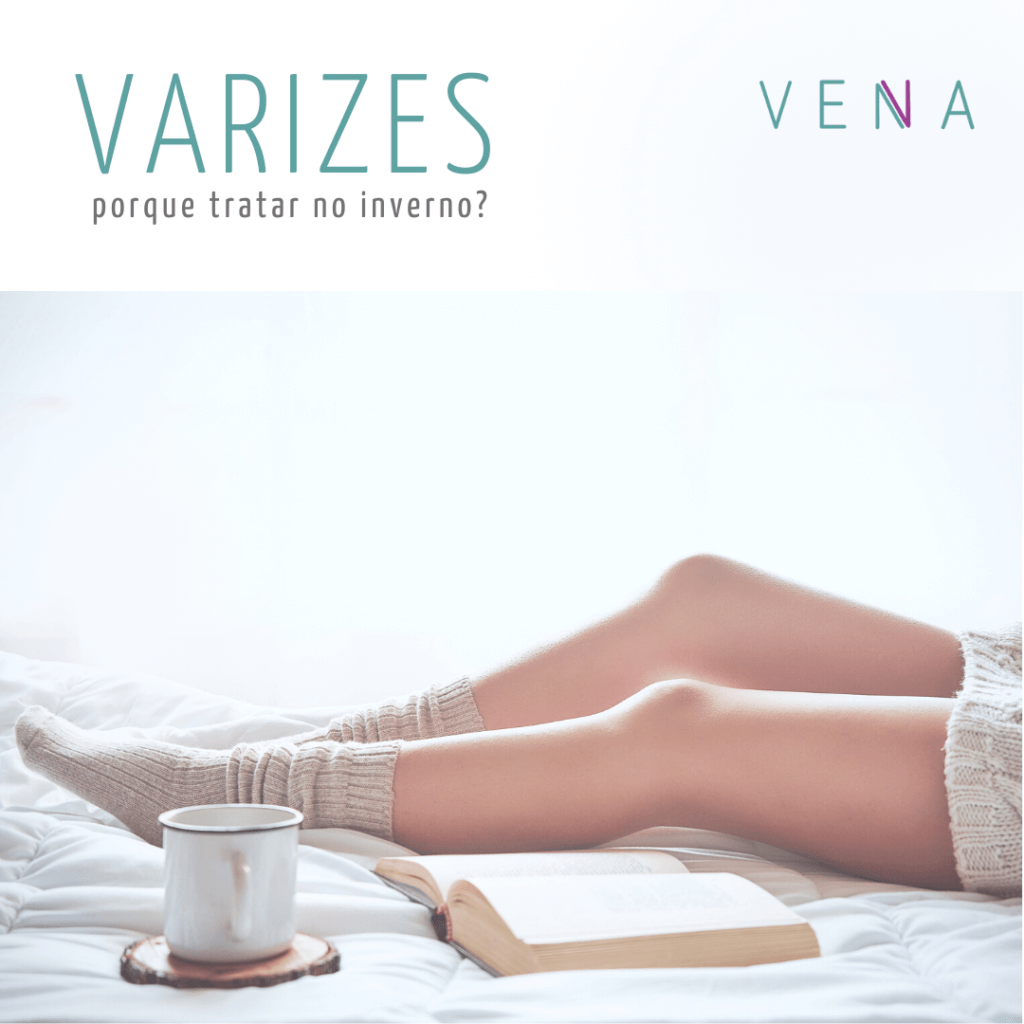 varizes-tratamento-inverno