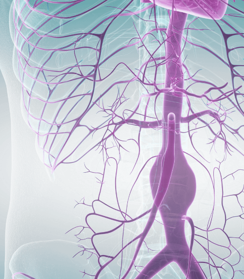 Correção de aneurismas de aorta