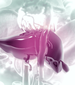Quimioembolização para tumor hepático