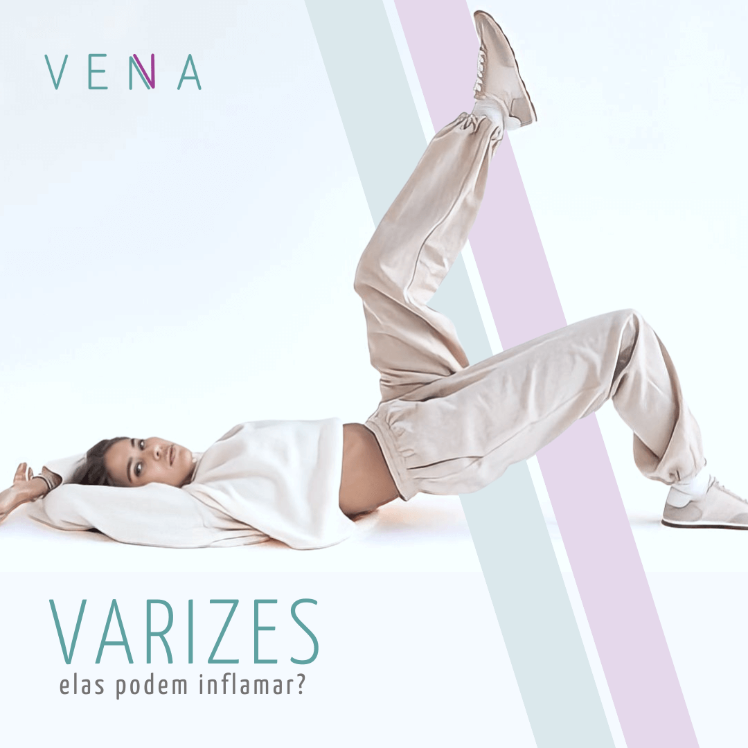varizes-inflamação
