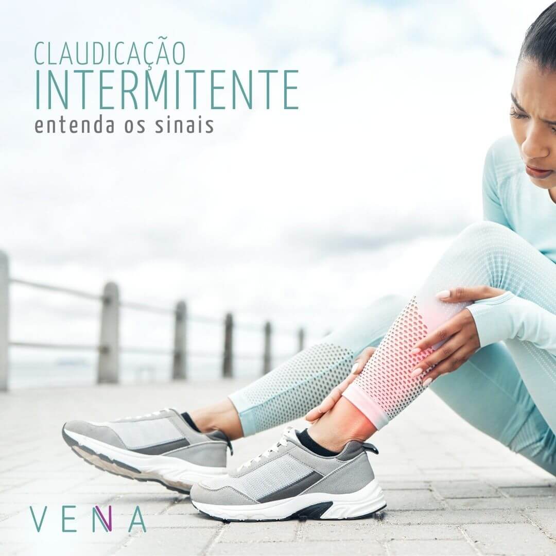 claudicação - intermitente