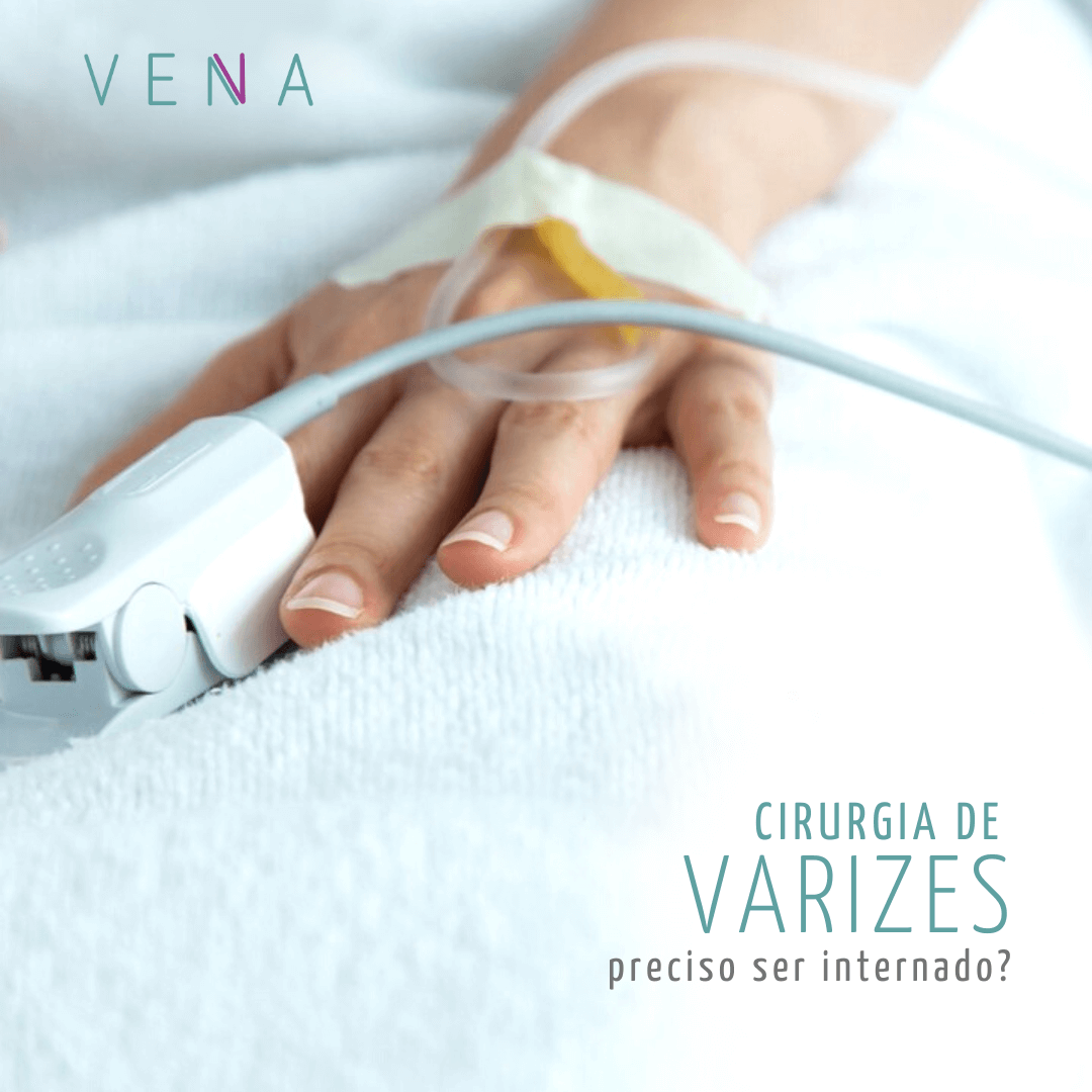 cirurgia-de-varizes