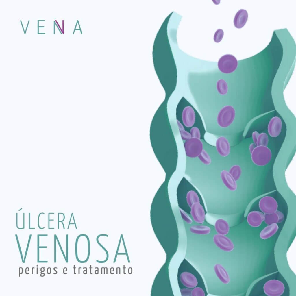 O tratamento para as úlceras venosas consiste em melhorar o fluxo sanguíneo local, eliminando a causa da hipertensão venosa.