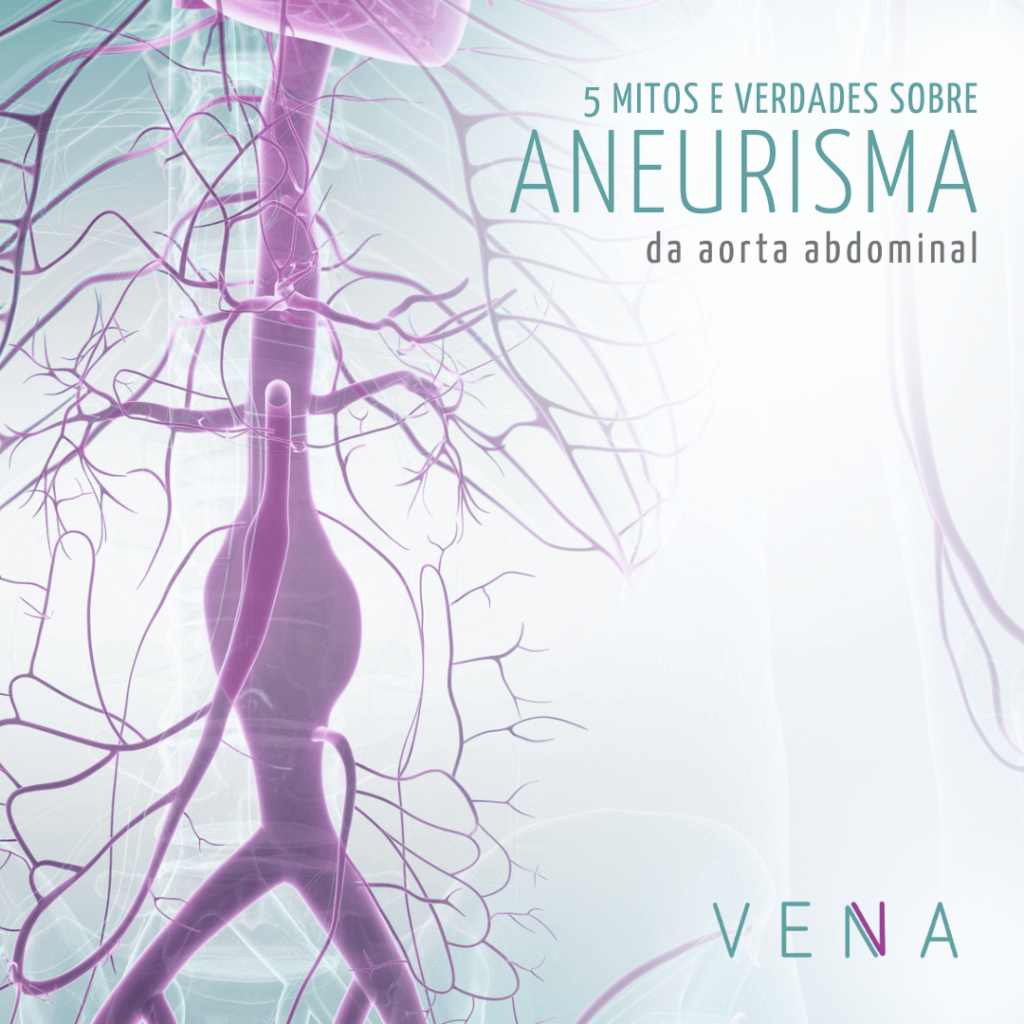 Ilustração de uma aorta abdominal com aneurisma