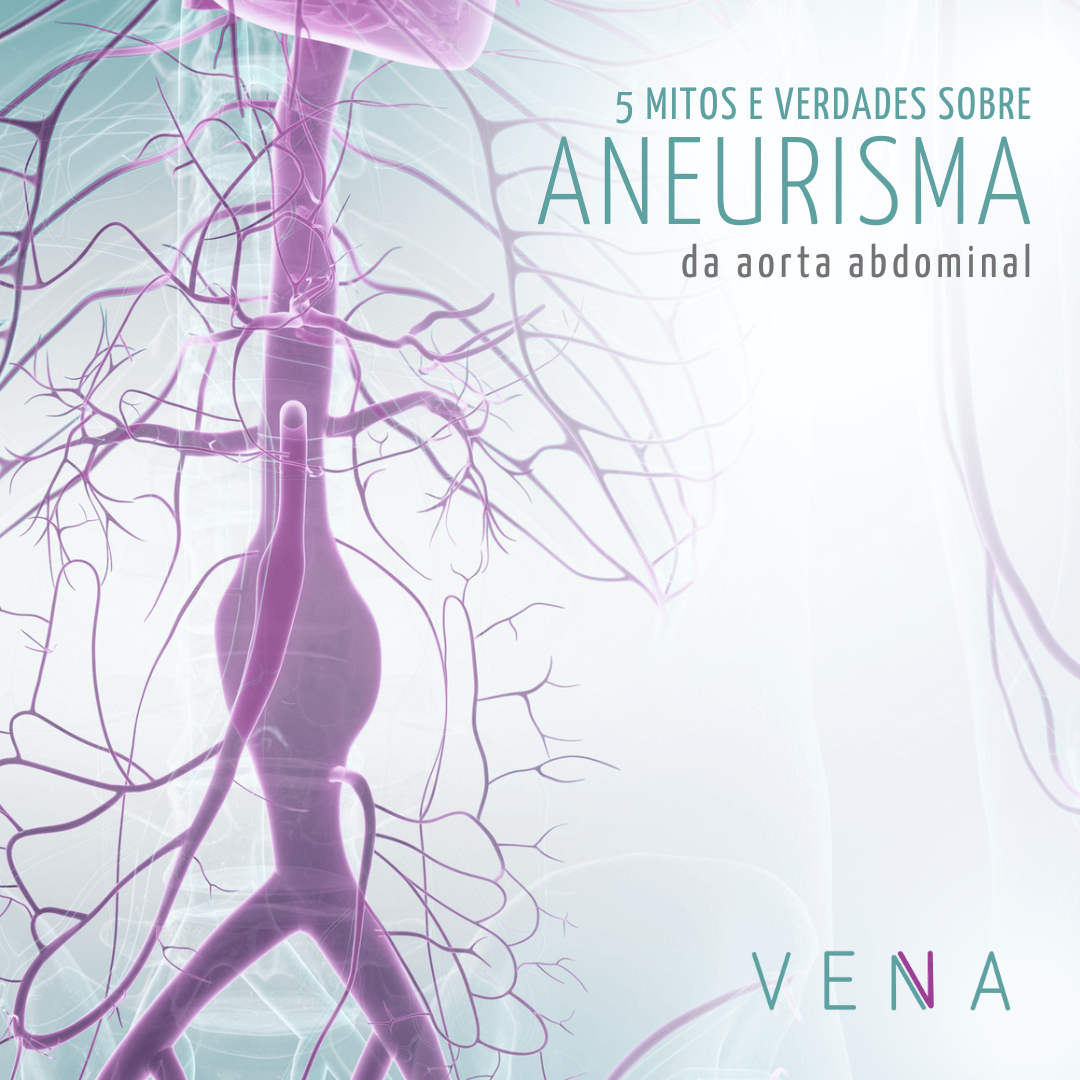 Ilustração de uma aorta abdominal com aneurisma