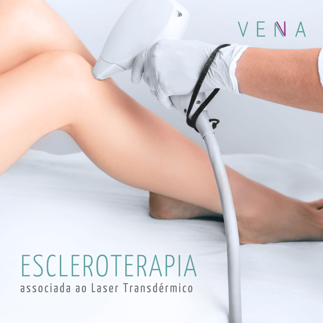 Cirurgião vascular aplicando laser transdérmico na perna de uma paciente
