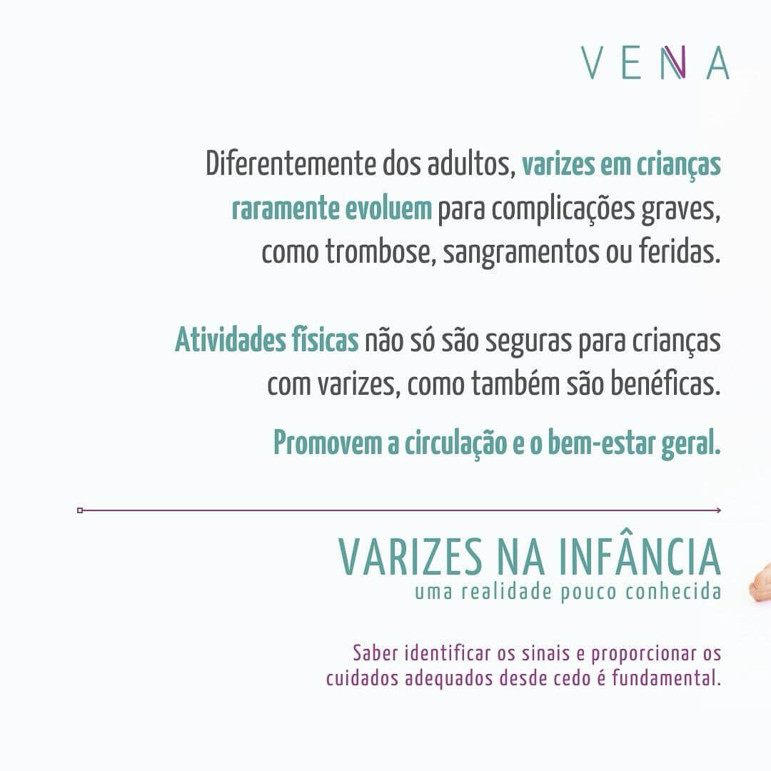 varizes-na-infancia