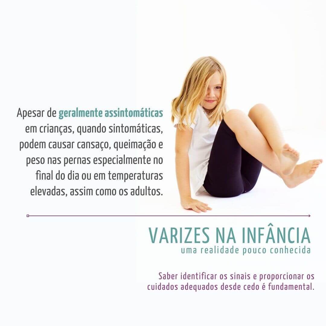 varizes-na-infancia