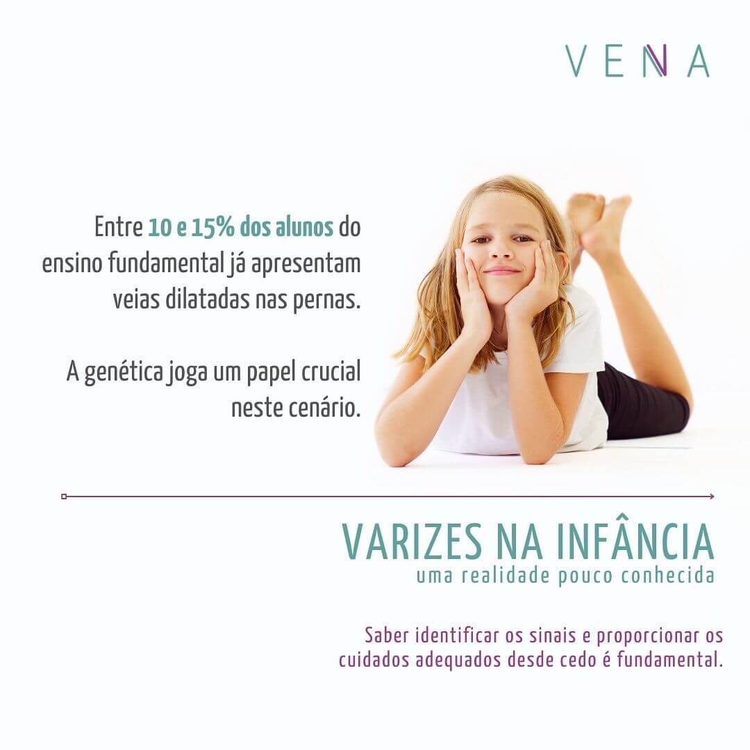 varizes-na-infancia