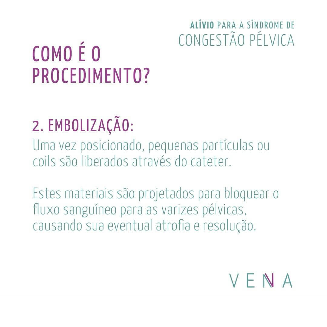 alivio-para-a-sindrome-de-congestao-pelvica