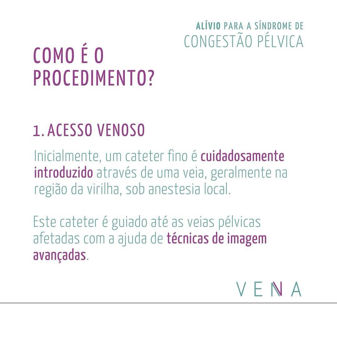 alivio-para-a-sindrome-de-congestao-pelvica