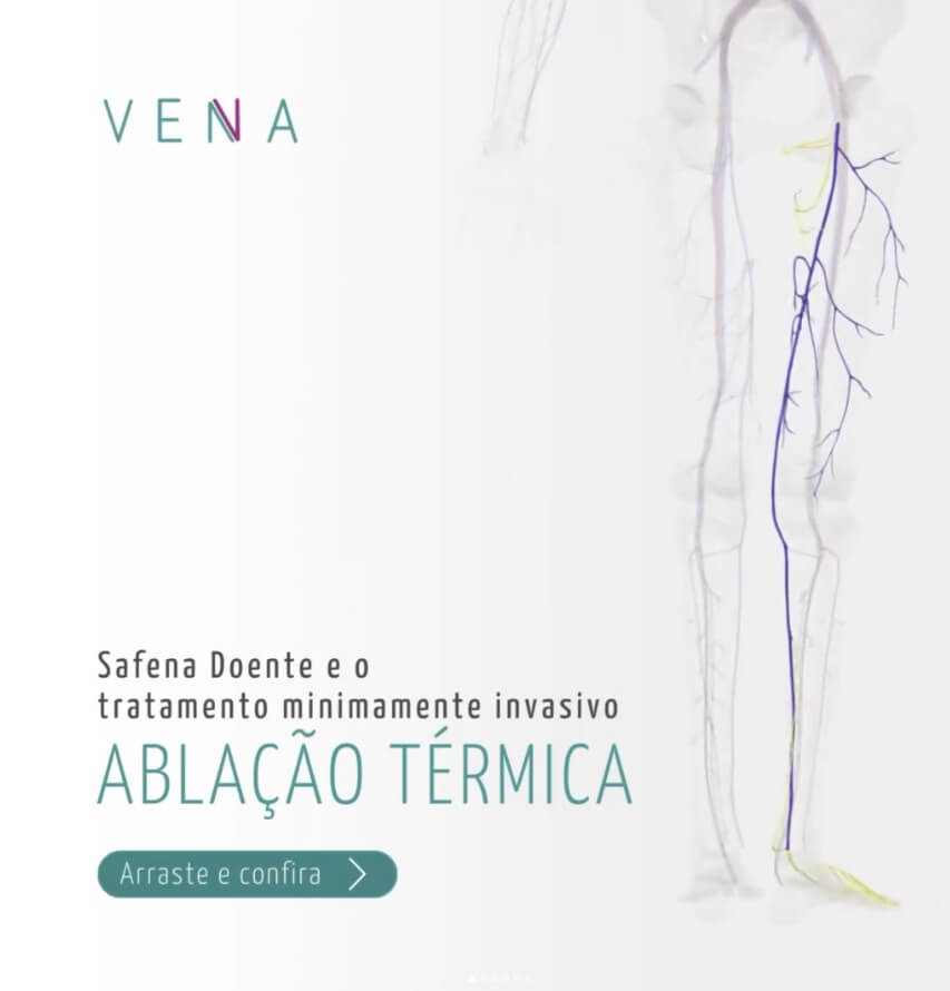 ablacao-termica