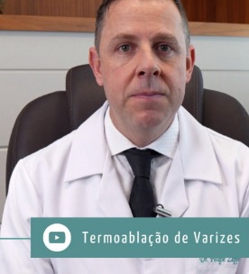 termoablacao-de-varizes