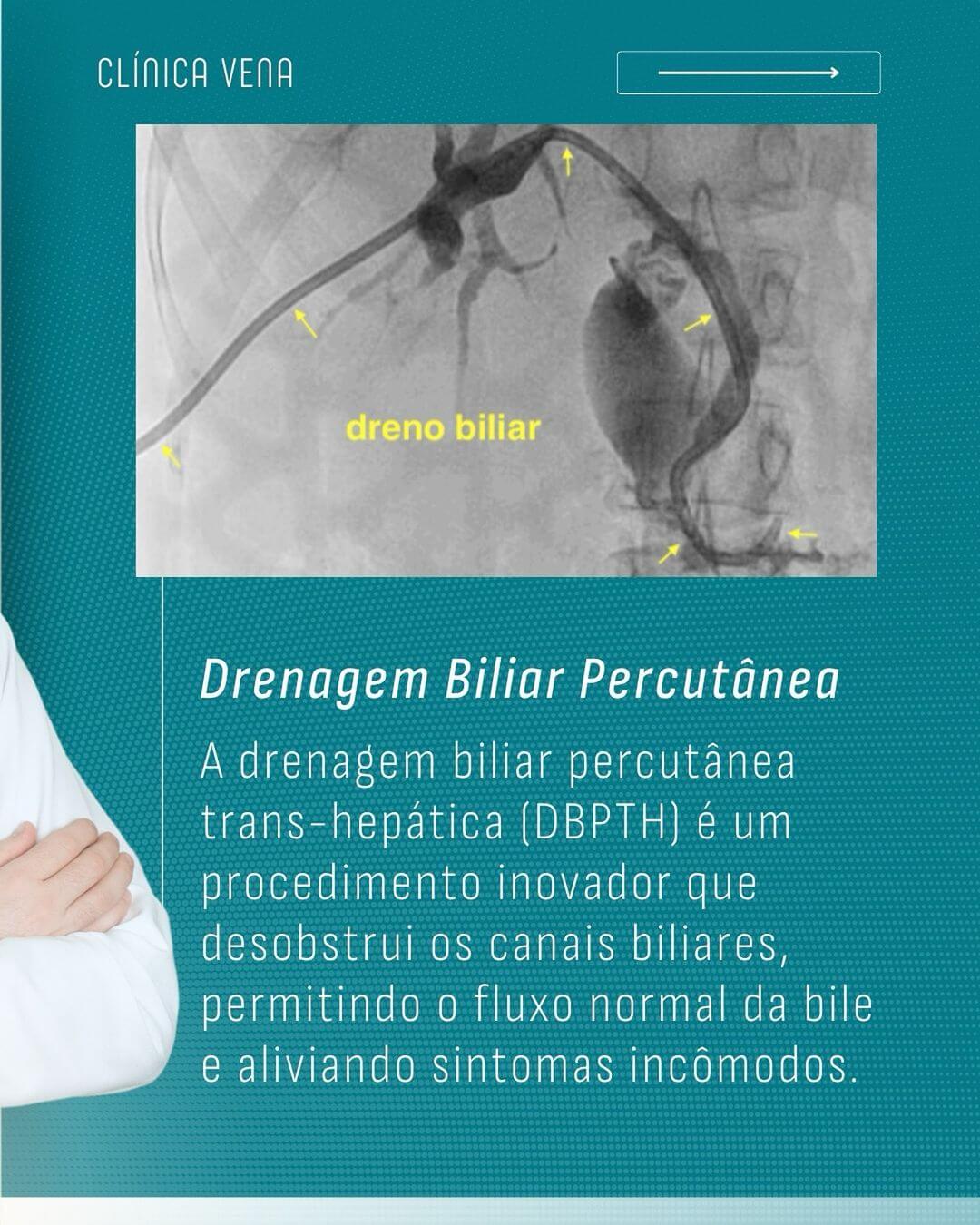 problemas-biliares