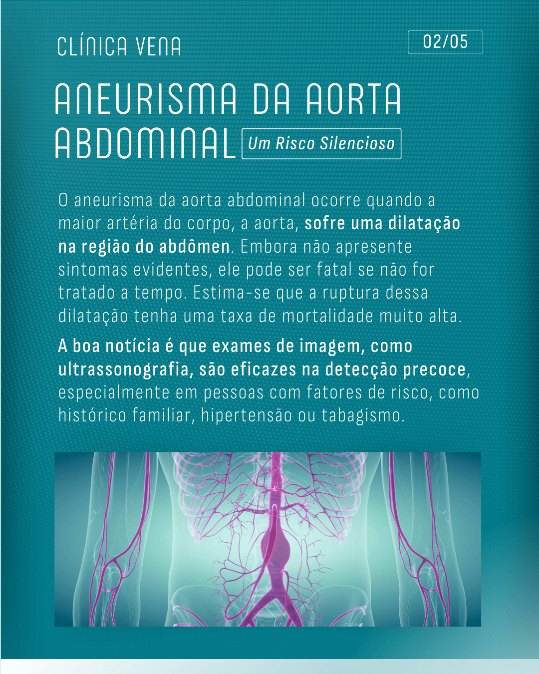 aneurismas-alem-do-cerebro