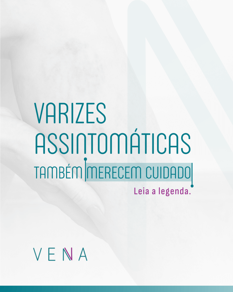 varizes-assintomaticas
