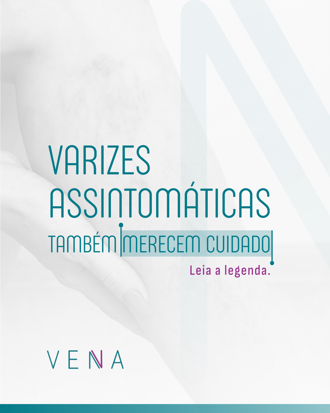 varizes-assintomaticas