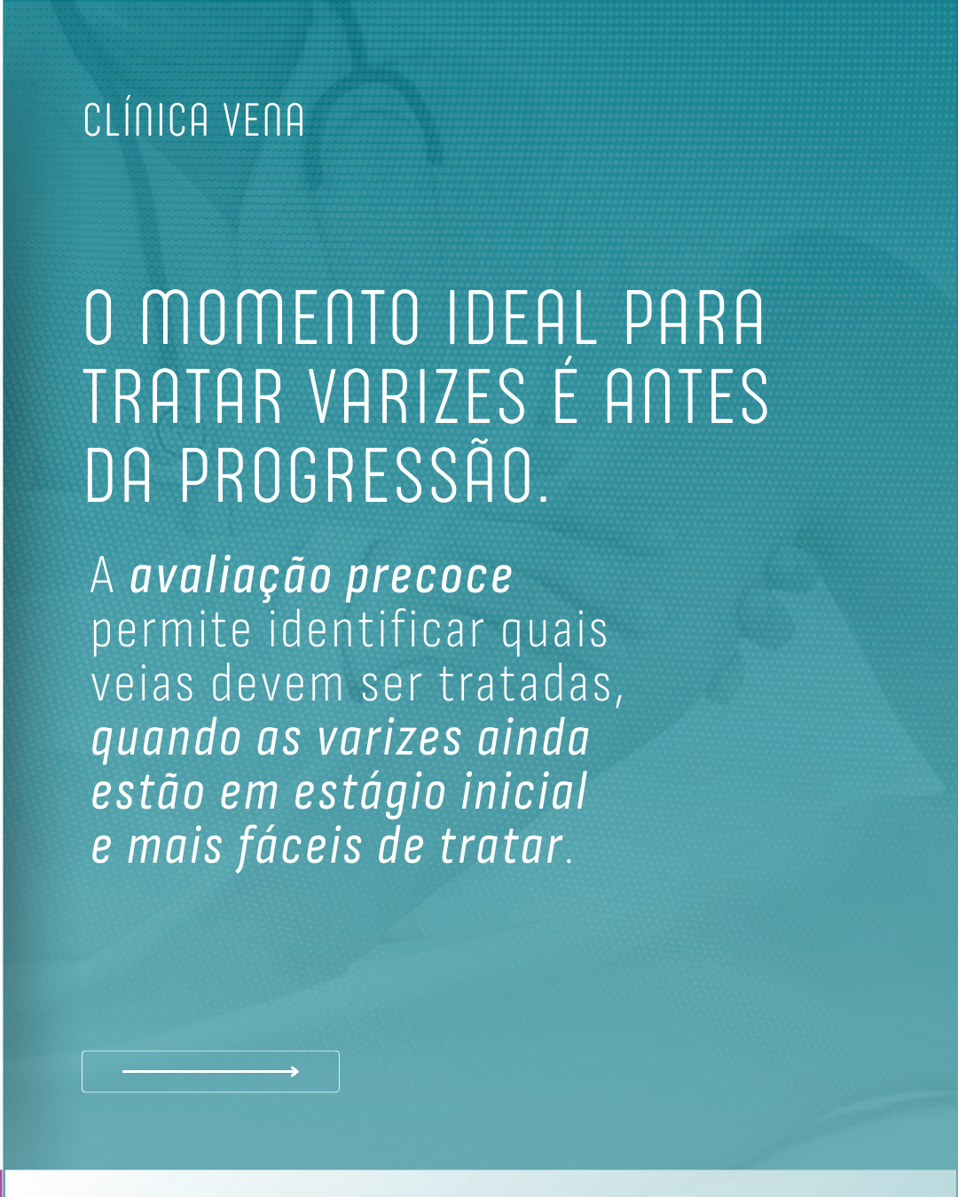 o-tratamento-das-varizes