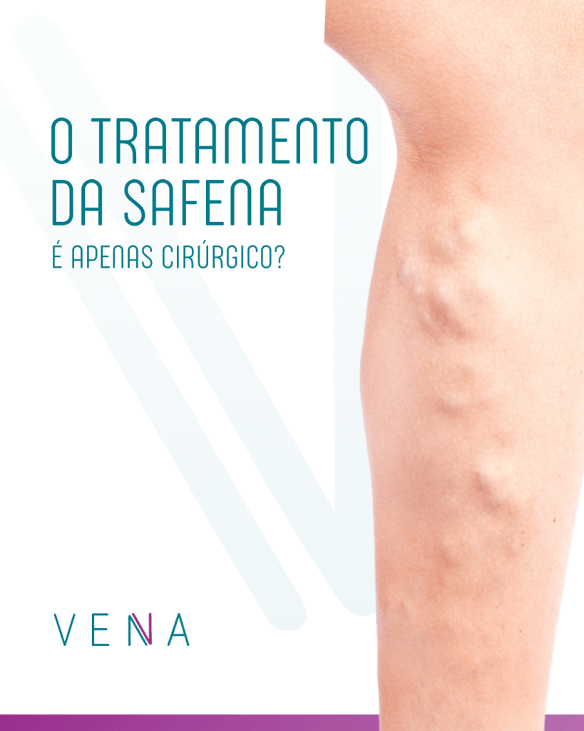 veia-safena-alterada