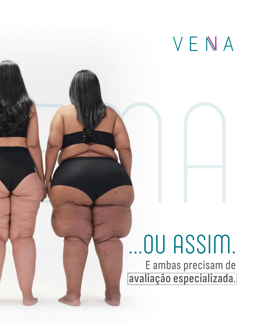 o-lipedema-nao-tem-uma-forma-unica