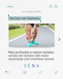 varizes-em-homens