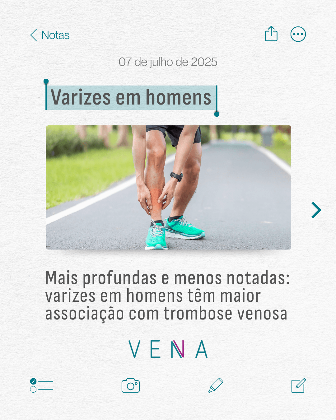 varizes-em-homens