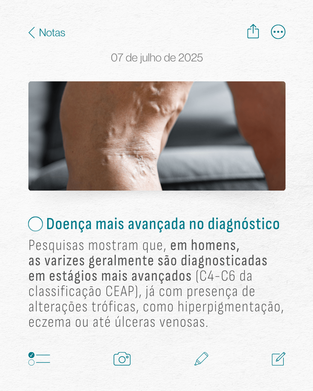 varizes-em-homens